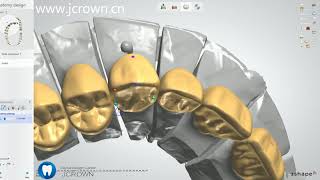 3shapeComplete Denture full mouth Design [upl. by Whalen]