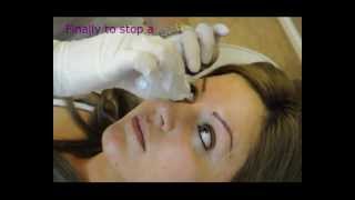 Permanent eyeliner  Makeup  Before and After  Tutorial by Redeem Clinic [upl. by Olson]