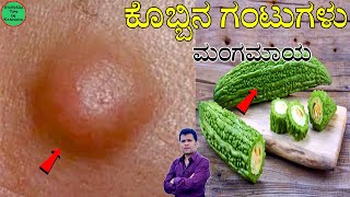 Lipoma Ayurvedic Treatment  lipoma mane maddu  lipoma ayurvedic treatment kannada  kobbina gantu [upl. by Hiasi]