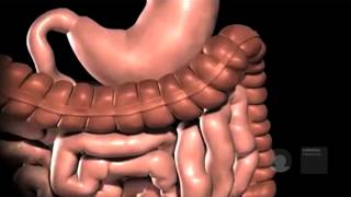 Gastric bypass in het Obesitascentrum Catharina Ziekenhuis [upl. by Jamill]