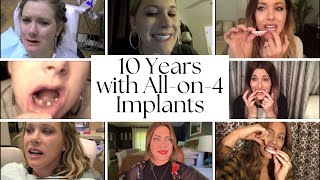 10 Years with Dental Implants [upl. by Oibirot]