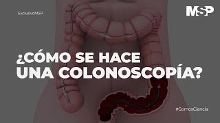 ¿Cómo se hace una colonoscopía ExclusivoMSP [upl. by Edna]