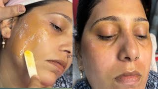 Full face wax by white chocolate wax facial hair kaise htayewaxing skincare waxingtips facewax [upl. by Kalvn986]