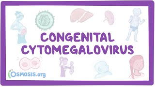 Congenital CMV  causes symptoms diagnosis treatment pathology [upl. by Koss]