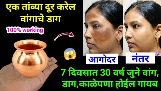 ना क्रीम ना पार्लर घरगुती पद्धतीने घालवा वांग आणि काळवटपणा 😱 kitchen tips  marathi kitchen  Tadka [upl. by Lebiram]