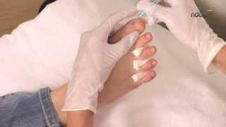 Tuto nail art pour ongles de pied  technique du millefeuille  ndedfr [upl. by Mimi]