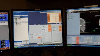 Varian 21iX OBI alignment demo [upl. by Jeffcott241]