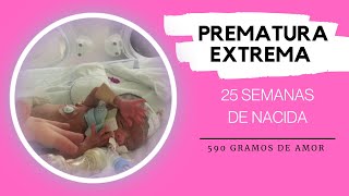 PREMATURA EXTREMA  25 semanas de vida 590 Gramos [upl. by Jesse]