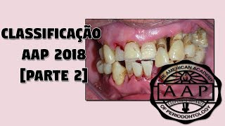 Parte 2 Classificação das Doenças Periodontais 2018  Nova Classificação da AAP 2018 [upl. by Daeriam]