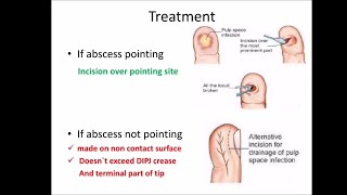 Hand infections ischeme [upl. by Eded]