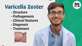 Chickenpox  Varicella zoster  Shingles  Human Herpes virus 6 7 8  Microbiology bangla lecture [upl. by Fessuoy]