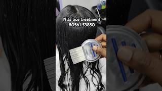 Nits lice treatment 100 result within 2 hrs Chennai headlicetreatmentliceremovalnitslicelice [upl. by Ydnor79]