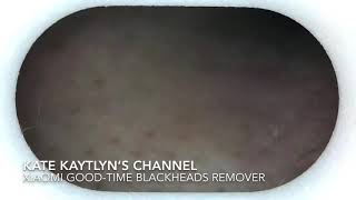 Xiaomi GoodTime Blackheads Removal 6 [upl. by Idnahs]