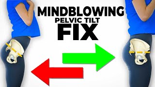 The Mindblowing Best Fix For Anterior Pelvic Tilt instant results [upl. by Malvie]