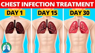 7 Natural Chest Infection Treatments Home Remedies [upl. by Suh]