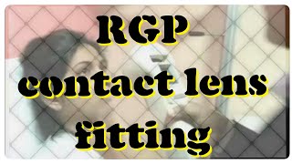 RGP contact lens fitting procedure  Sri Sankaradeva Nethralaya Guwahati [upl. by Barina905]