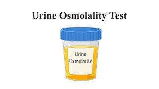 Urine osmolality test purposeprocess  calculation laboratory labtechnicians [upl. by Arahs]