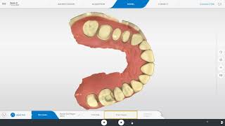 Primescan Connect SW 50 Step By Step [upl. by Neahs473]