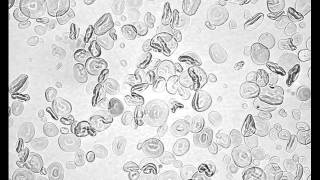 Heat Gelatinization of Wheat Starch low iodine [upl. by Harbour]