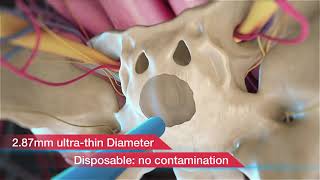 Complete Pituitary Tumor Visualization [upl. by Guntar]