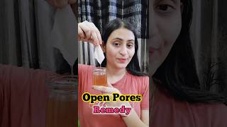 Remedy for Open Pores ❤️ Homemade Remedy shorts ytshorts openpores diy hack skincare trending [upl. by Hsima]