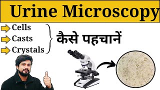 Microscopic Examination of Urine  Urine Analysis in Hindi  Crystals  Casts  Lab Practical [upl. by Nnylsor]