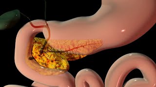 Pancreas Explained  3D Animation [upl. by Elahcar]