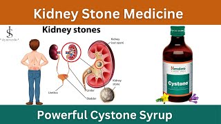 Cystone syrup uses in hindi  cystone syrup kaise pina hai  cystone syrup dosage [upl. by Jacie]