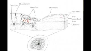 Understanding the Natural Approach to Osteoporosis  Part 1 [upl. by Aihsat]