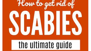 How To Get Rid Of Scabies A Guide That WORKS [upl. by Nart]