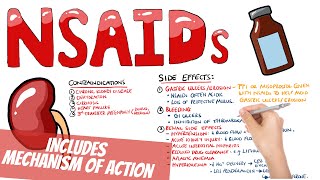 Non Steroidal AntiInflammatory Drugs NSAIDs Pharmacology  What do NSAIDs do How do NSAIDs work [upl. by Bullivant]