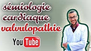 sémiologie cardiaque valvulopathie gauche [upl. by Airdnala134]