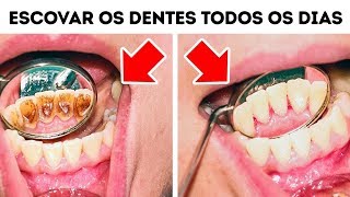 10 Erros Que Você Comete Ao Cuidar Dos Dentes [upl. by Zina]