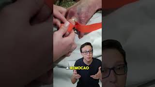 Como remover Anel Preso 😲💍 medico enfermagem enfermeira medicina saude curiosidades dicas [upl. by Ennayar]