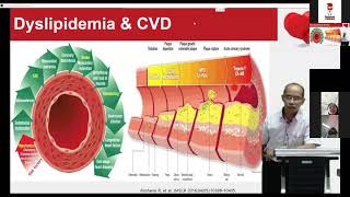 HYPERTRIGLYCERIDEMIA  The Update Management [upl. by Goldston139]