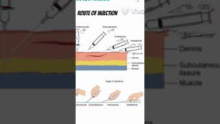 Different route of injection administration of drugs route injection shorts 3danimation viral [upl. by Adnol]