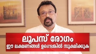 എന്താണ് ലൂപസ് രോഗം  SLE or Lupus Disease Malayalam Health Tips [upl. by Vial]