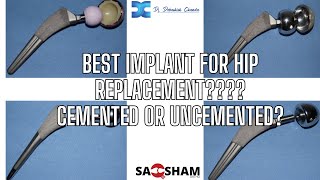 Best implant for hip replacementCemented or Uncemented DrdebashishChanda [upl. by Lura]