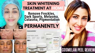 💯Permanent Whiter Skin at home Cosmelan Peel Review Before and After Cosmelan Treatment Lighten Skin [upl. by Virginia]