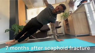 7 months after scaphoid fracture recovery update exercises progress [upl. by Eidnew]