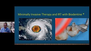 Minimally invasive therapy and ART with Biodentine  Septodont webinar by Dr Yepes [upl. by Penhall]