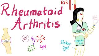 Rheumatoid arthritis Part 5 Atlantoaxial instability subluxation [upl. by Rye]