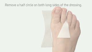 How to apply Mepilex Transfer between the toes [upl. by Repsag]