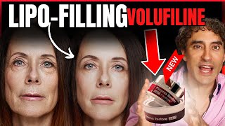 Volufiline Cream  Filler Without The Needles [upl. by Eniluqcaj]