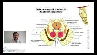 TALLO CEREBRAL ANATOMIA [upl. by Jacinthe]