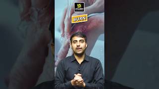 Bacteria is most commonly responsible for the sepsis in the burn patient shorts mukeshsir [upl. by Tamis]