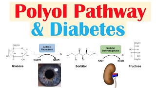 Polyol Pathway amp Diabetes  The Role of Polyol Pathway in Diabetes Pathogenesis [upl. by Alimhaj868]