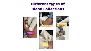 Different types of Blood Collection [upl. by Nanni23]