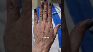 Hands Fascia Blaster Review  Before and After [upl. by Ahsienor813]