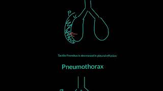 Tactile Fremitus Explained [upl. by Juley]